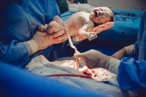 Este posibil sa nasti vaginal dupa cezariana de la primul copil?