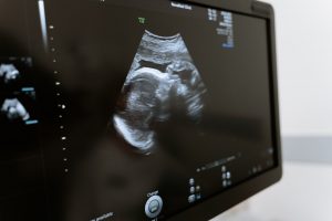 Travaliul prematur si nasterea prematura. Factori de risc si prevenire