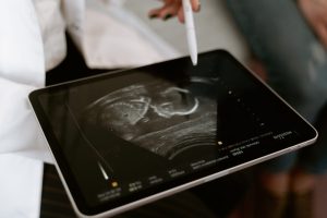 Sarcina criptica, o sarcina de care probabil nici nu stii pana ajungi la ginecolog sau in sala de nasteri