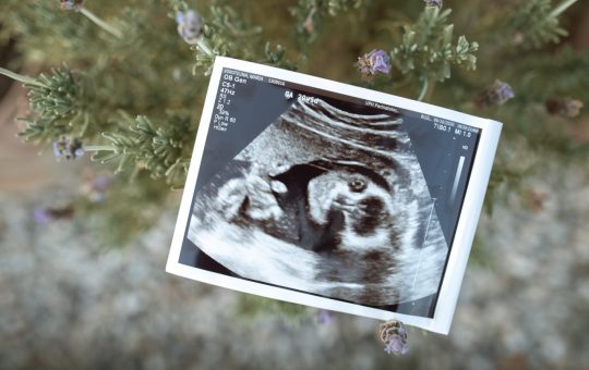 Sunt fertilitatea, aparitia unei sarcini sau ovulatia influentate de masturbare?