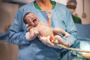 Compresia cordonului ombilical in timpul travaliului si nasterii. De ce apare si cum poate fi prevenita?