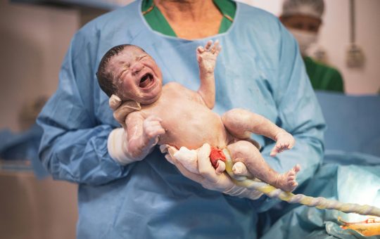 Compresia cordonului ombilical in timpul travaliului si nasterii. De ce apare si cum poate fi prevenita?