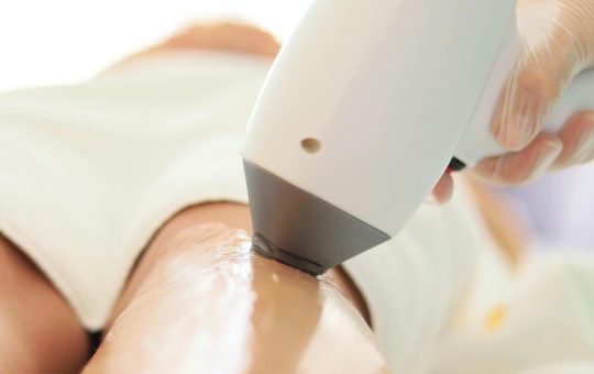 De este importanta vizita la dermatolog inainte de a merge la o epilare definitiva laser Iaşi la salon?