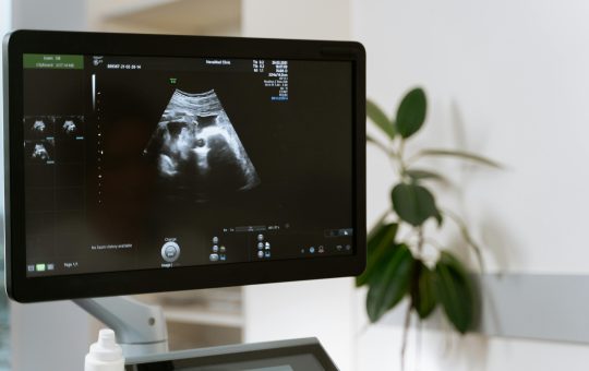 Placenta anterioara. Ce este, diagnosticare si complicatii