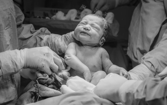 Spectrul de placenta accreta (PAS), o cauza a complicatiilor in sarcina si la nastere