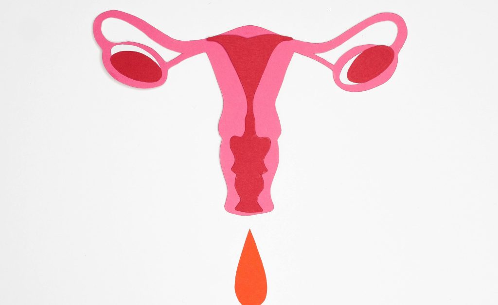 Insuficienta ovariana primara, o cauza des intalnita a infertilitatii feminine