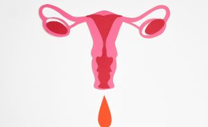Insuficienta ovariana primara, o cauza des intalnita a infertilitatii feminine