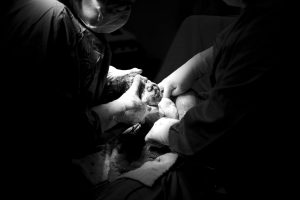 Sindromul Hamman sau pneumomediastin spontan in timpul travaliului, nasterii