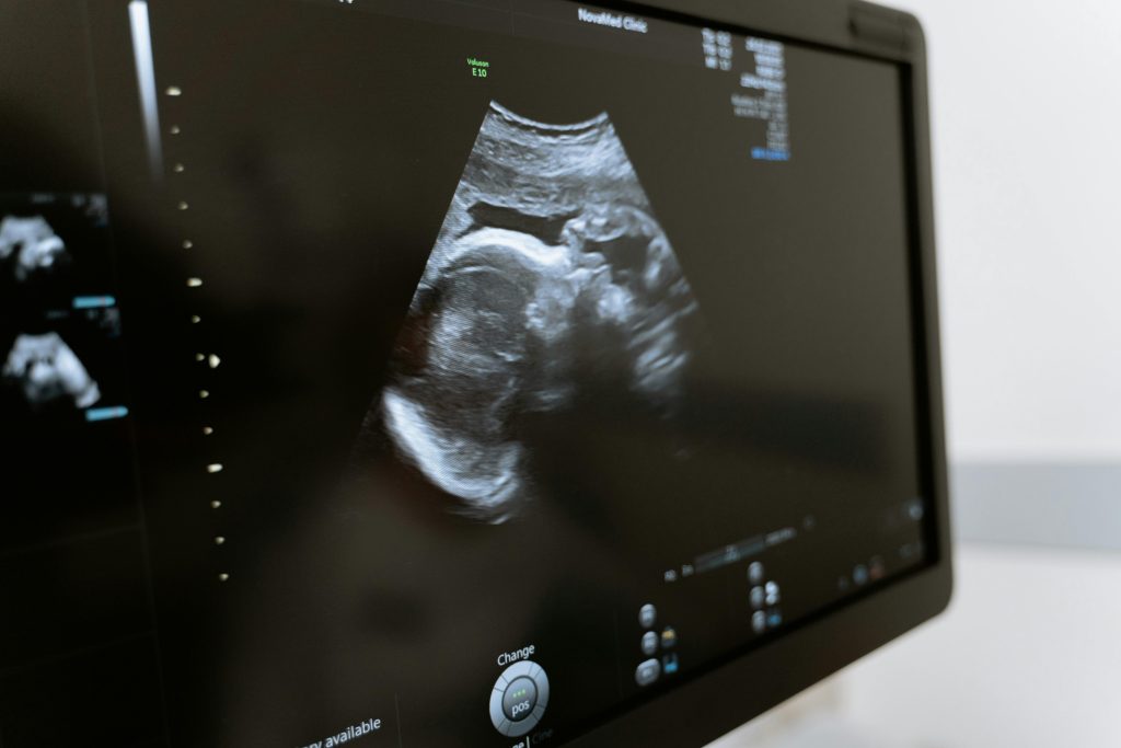 Terapia de inlocuire mitocondriala (MRT), tehnologia reproductiva care previne transmiterea bolilor ereditare de la mama la copil