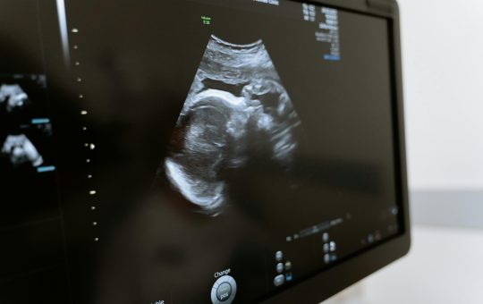 Terapia de inlocuire mitocondriala (MRT), tehnologia reproductiva care previne transmiterea bolilor ereditare de la mama la copil