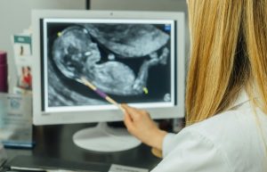 Sindromul Transfuzor-Transfuzat (STT): Ghid complet despre complicatia grava din sarcina gemelara