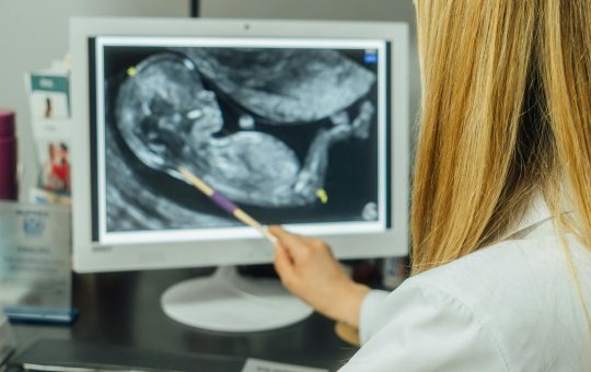 Sindromul Transfuzor-Transfuzat (STT): Ghid complet despre complicatia grava din sarcina gemelara
